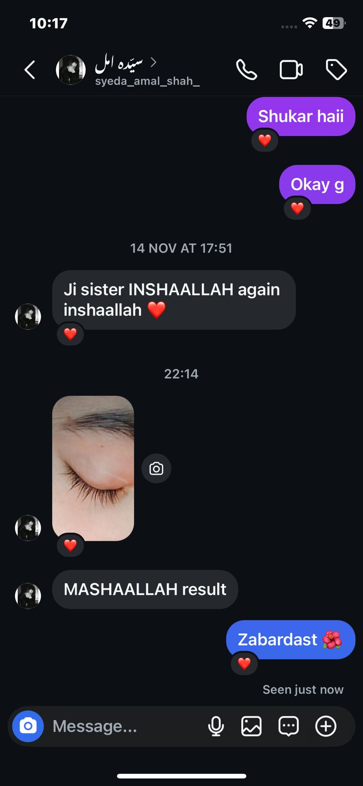 Long Lashes Serum by skin glow