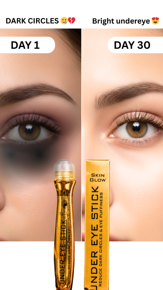 Under Eye Serum by skin glow